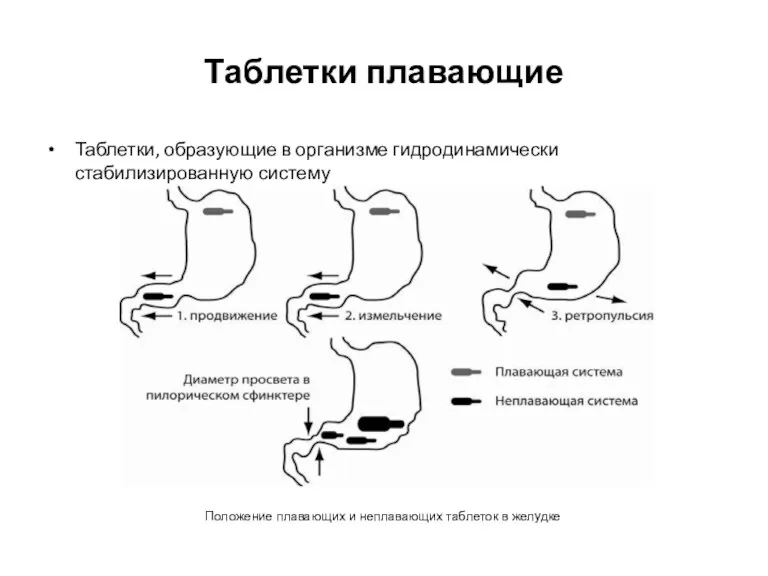 Таблетки плавающие Таблетки, образующие в организме гидродинамически стабилизированную систему Положение плавающих и неплавающих таблеток в желудке