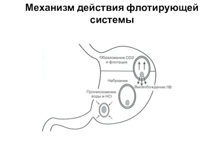 Механизм действия флотирующей системы