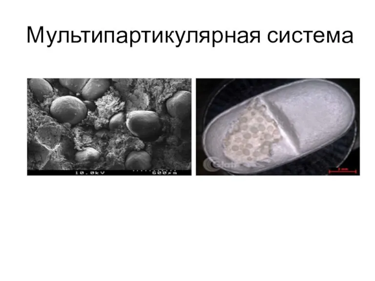 Мультипартикулярная система