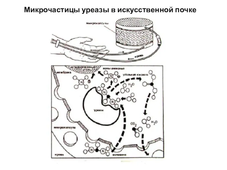 Микрочастицы уреазы в искусственной почке