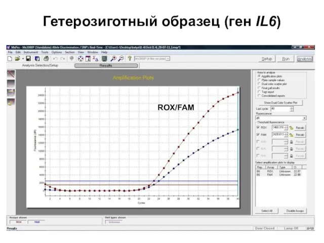 Гетерозиготный образец (ген IL6)