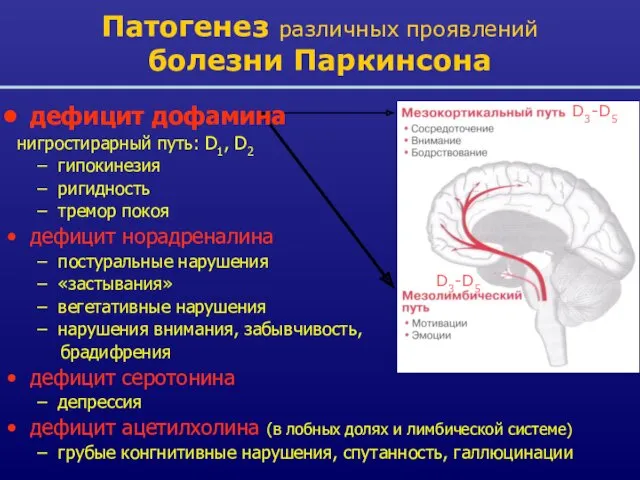Патогенез различных проявлений болезни Паркинсона D3-D5 D3-D5 дефицит дофамина нигростирарный