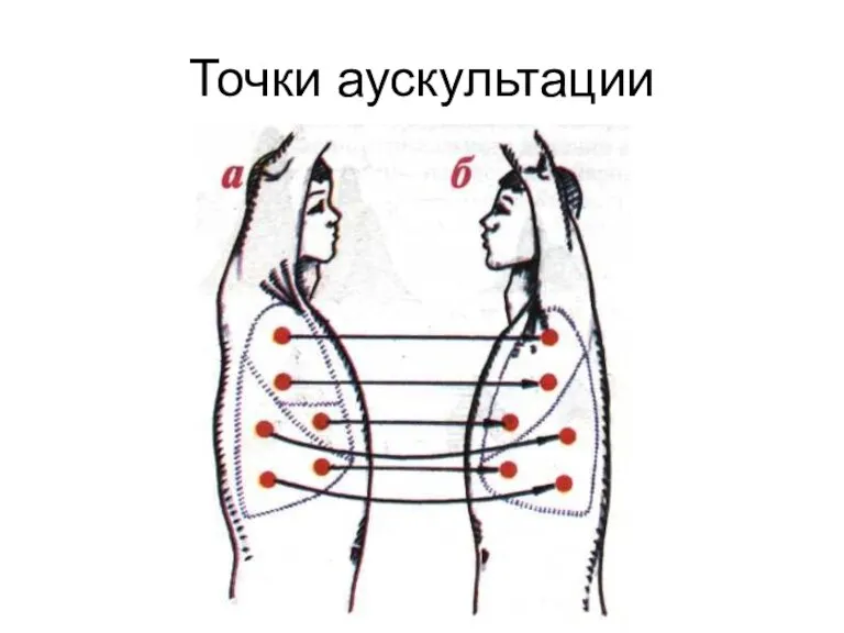 Точки аускультации