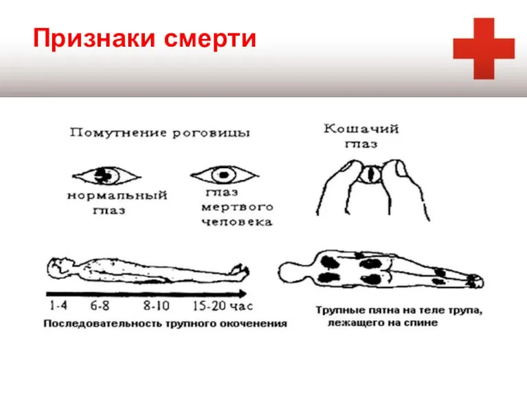 Признаки смерти