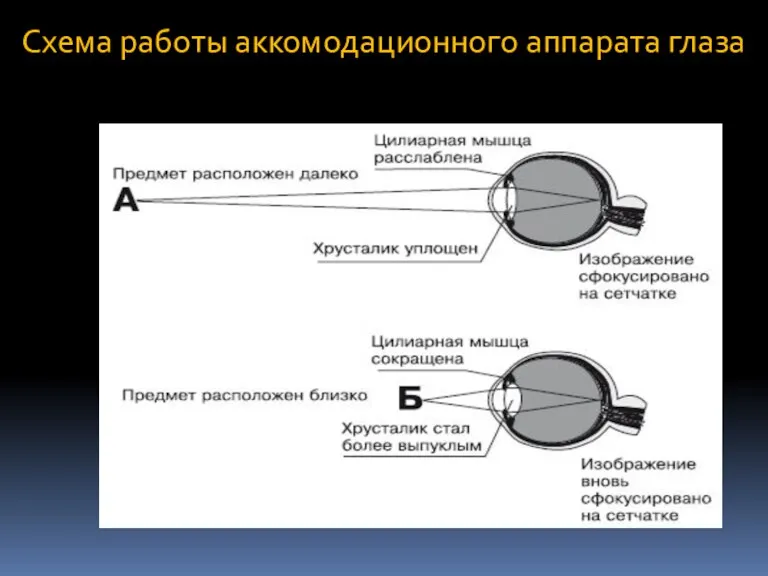 Схема работы аккомодационного аппарата глаза