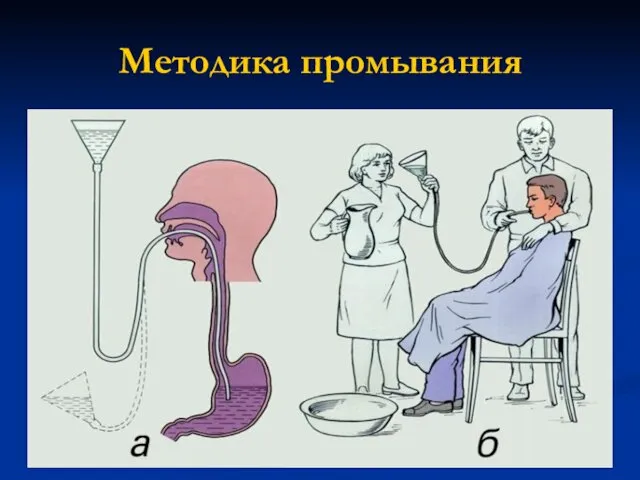 Методика промывания