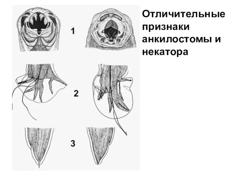 Отличительные признаки анкилостомы и некатора