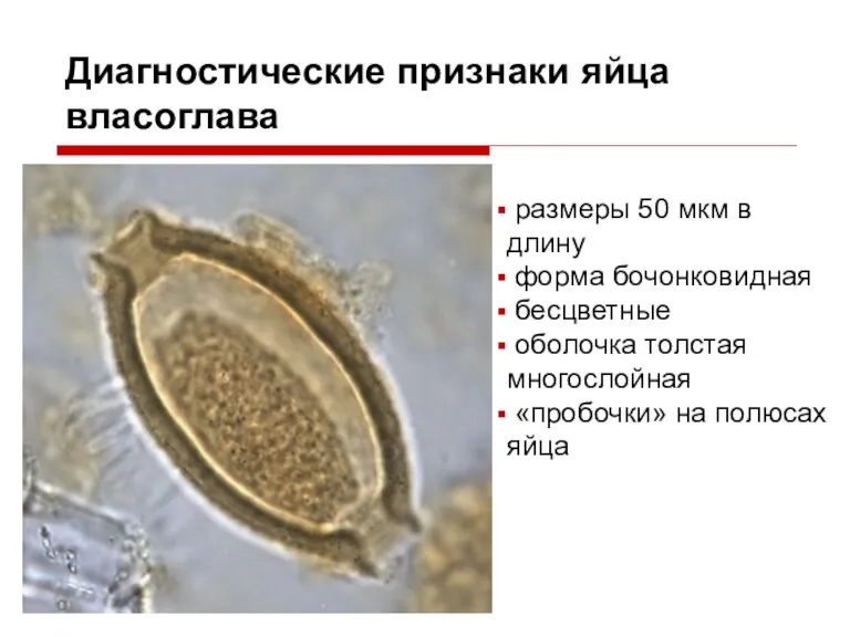 Диагностические признаки яйца власоглава размеры 50 мкм в длину форма