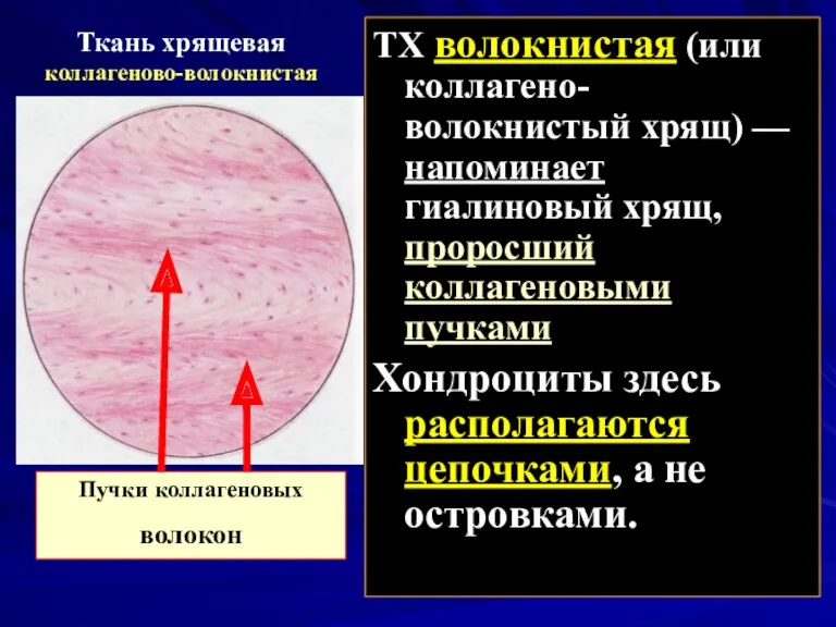 Ткань хрящевая коллагеново-волокнистая ТХ волокнистая (или коллагено-волокнистый хрящ) — напоминает