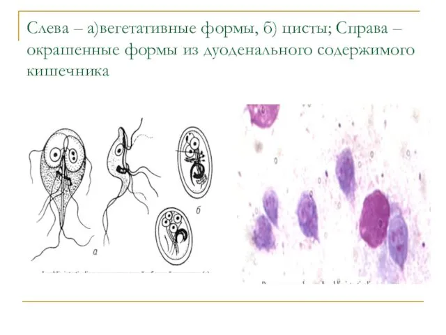 Слева – а)вегетативные формы, б) цисты; Справа – окрашенные формы из дуоденального содержимого кишечника