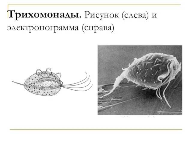 Трихомонады. Рисунок (слева) и электронограмма (справа)