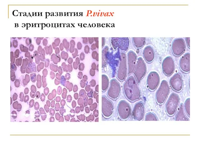 Стадии развития P.vivax в эритроцитах человека