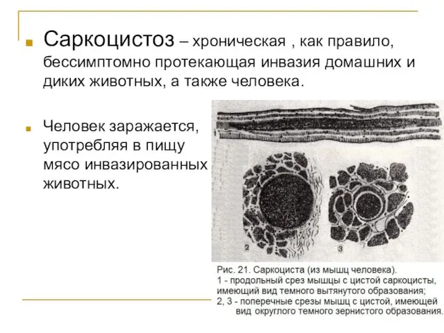 Саркоцистоз – хроническая , как правило, бессимптомно протекающая инвазия домашних