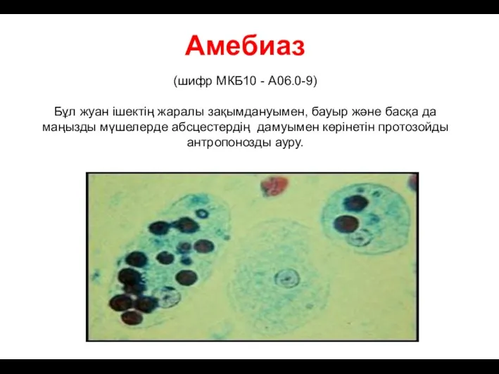 Амебиаз (шифр МКБ10 - A06.0-9) Бұл жуан ішектің жаралы зақымдануымен,