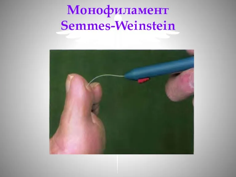 Монофиламент Semmes-Weinstein