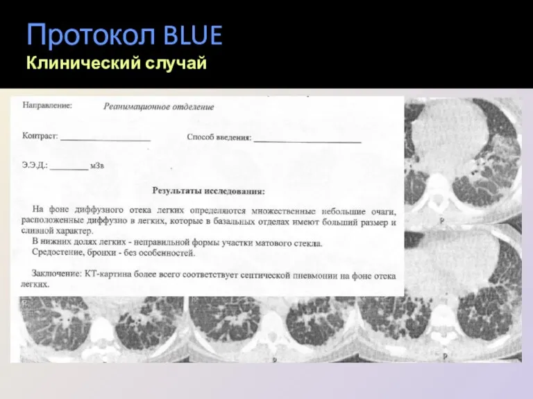 Протокол BLUE Клинический случай
