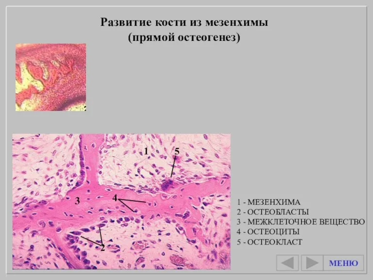 Развитие кости из мезенхимы (прямой остеогенез) 1 - МЕЗЕНХИМА 2