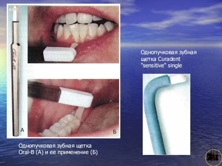 АНИСИМОВА Л.В.кмн. Однопучковая зубная щетка Oral-B (А) и ее применение (Б) А Б
