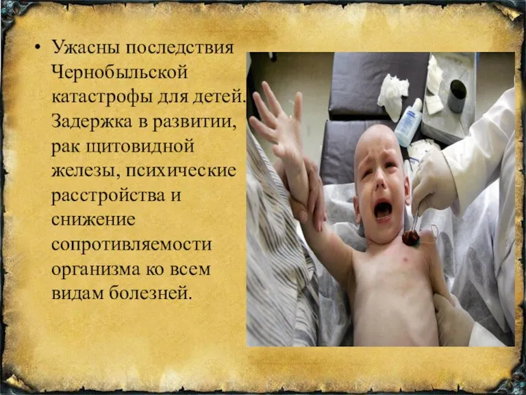 Ужасны последствия Чернобыльской катастрофы для детей. Задержка в развитии, рак щитовидной железы, психические