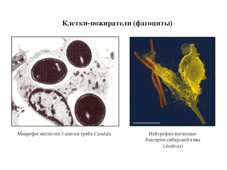 Клетки-пожиратели (фагоциты) Макрофаг поглотил 3 клетки гриба Candida Нейтрофил поглощает бактерии сибирской язвы (Anthrax)