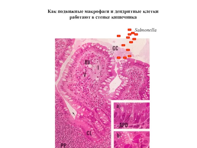 Как подвижные макрофаги и дендритные клетки работают в стенке кишечника Salmonella