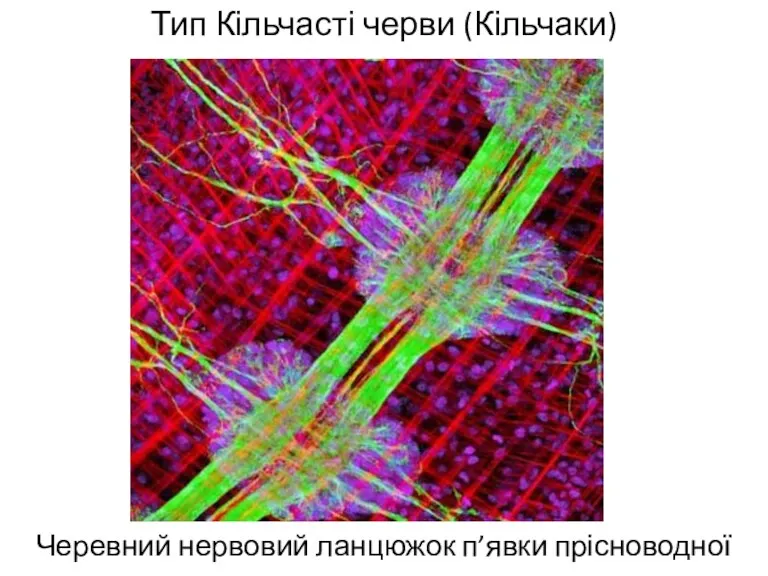 Тип Кільчасті черви (Кільчаки) Черевний нервовий ланцюжок п’явки прісноводної