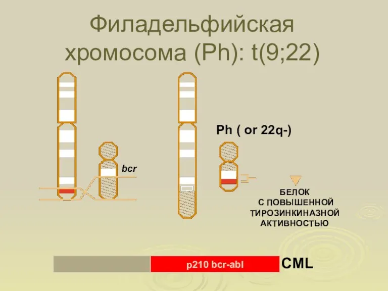 Филадельфийская хромосома (Ph): t(9;22) 22 bcr abl Ph ( or 22q-) bcr-abl 9