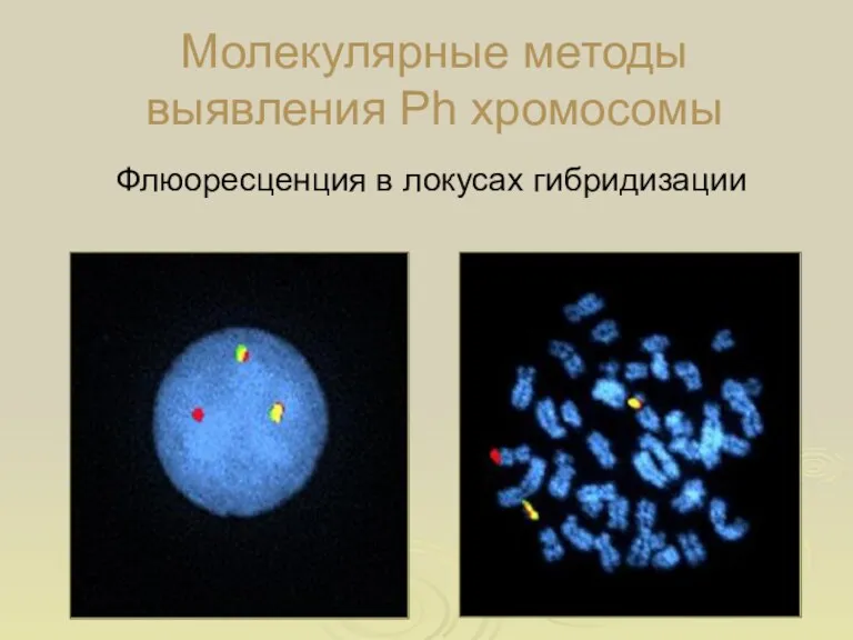 Флюоресценция в локусах гибридизации Интерфаза Метафаза Молекулярные методы выявления Ph хромосомы