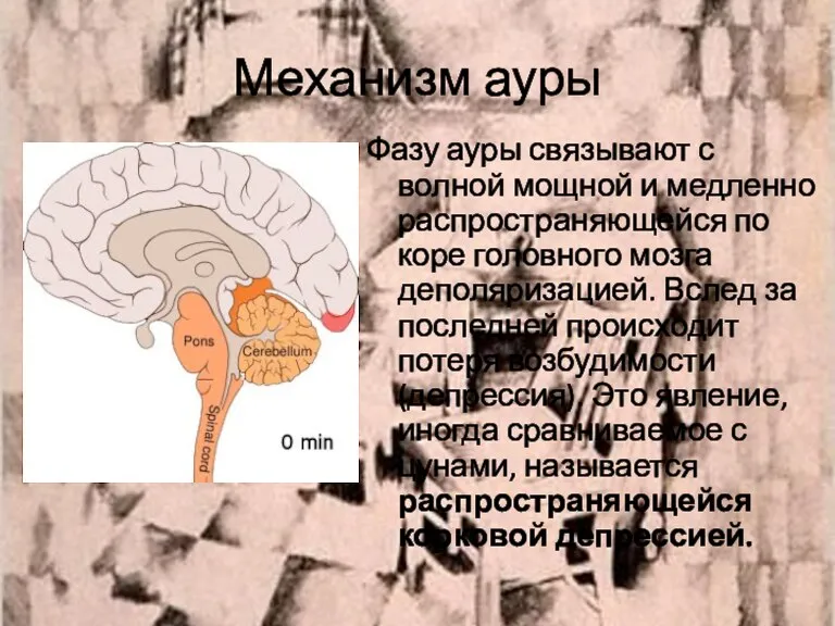 Механизм ауры Фазу ауры связывают с волной мощной и медленно