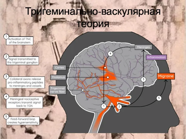 Тригеминально-васкулярная теория