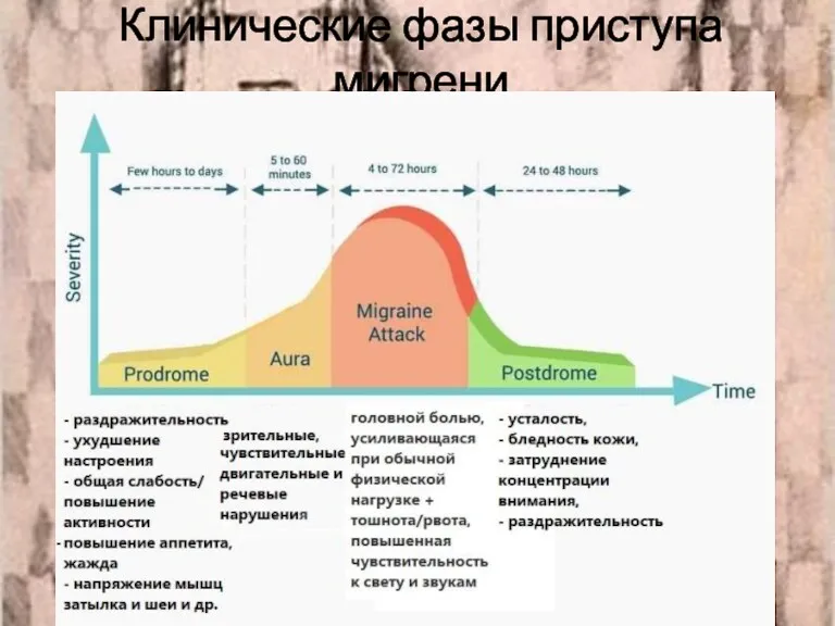 Клинические фазы приступа мигрени