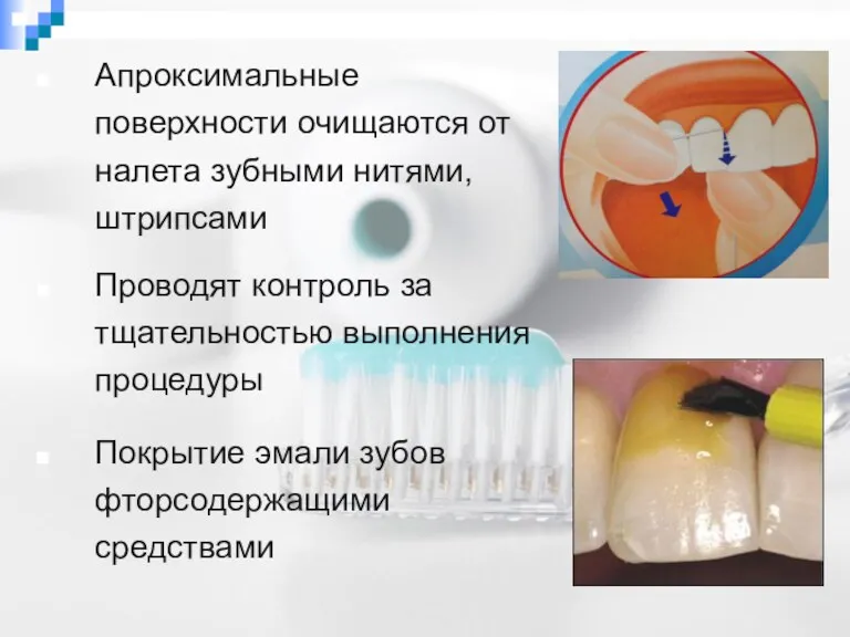 Апроксимальные поверхности очищаются от налета зубными нитями, штрипсами Проводят контроль