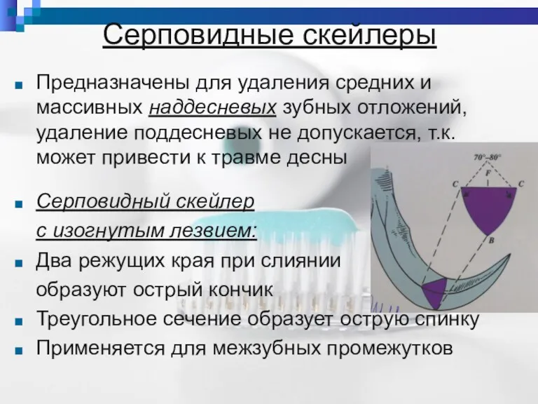 Серповидные скейлеры Предназначены для удаления средних и массивных наддесневых зубных