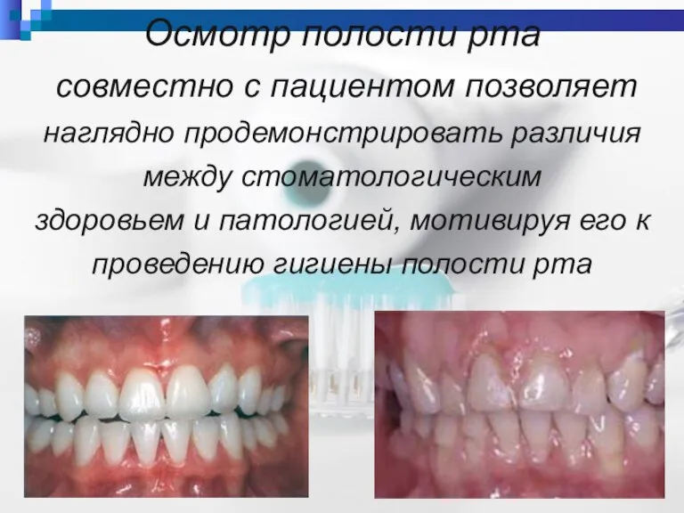 Осмотр полости рта совместно с пациентом позволяет наглядно продемонстрировать различия