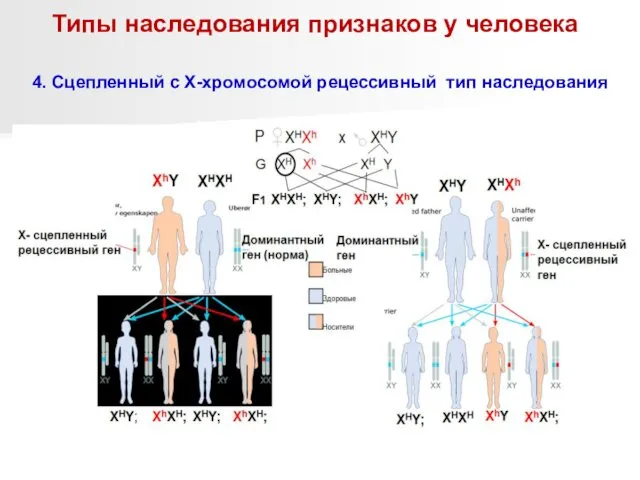 Типы наследования признаков у человека 4. Сцепленный с Х-хромосомой рецессивный тип наследования