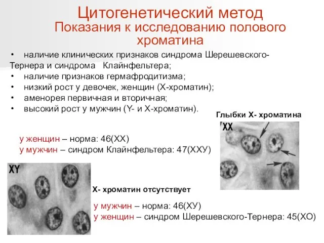 наличие клинических признаков синдрома Шерешевского- Тернера и синдрома Клайнфельтера; наличие