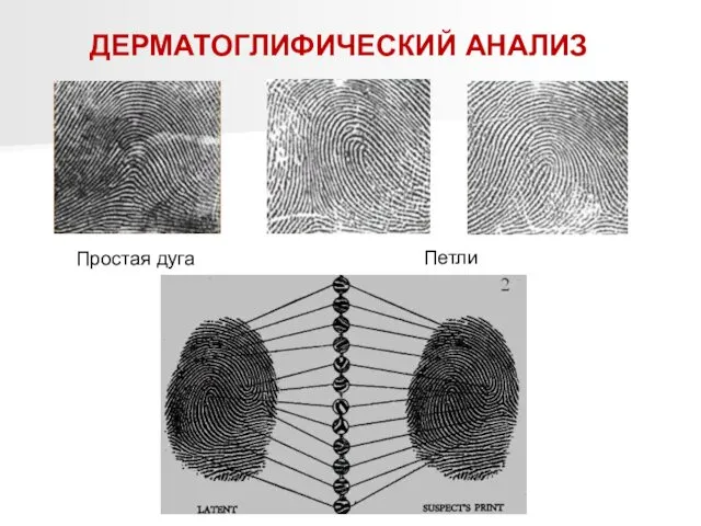 ДЕРМАТОГЛИФИЧЕСКИЙ АНАЛИЗ Простая дуга Петли