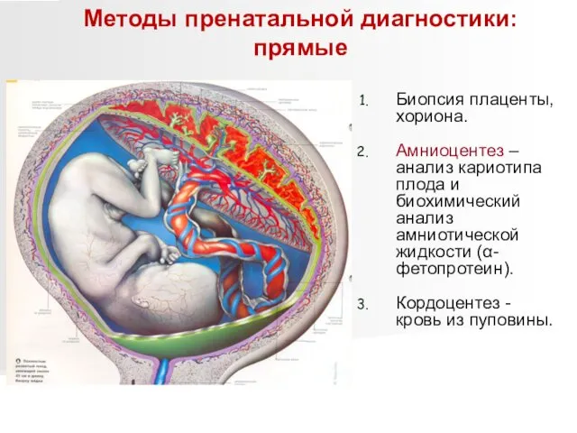 Биопсия плаценты, хориона. Амниоцентез – анализ кариотипа плода и биохимический