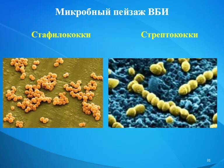 Микробный пейзаж ВБИ Стафилококки Стрептококки