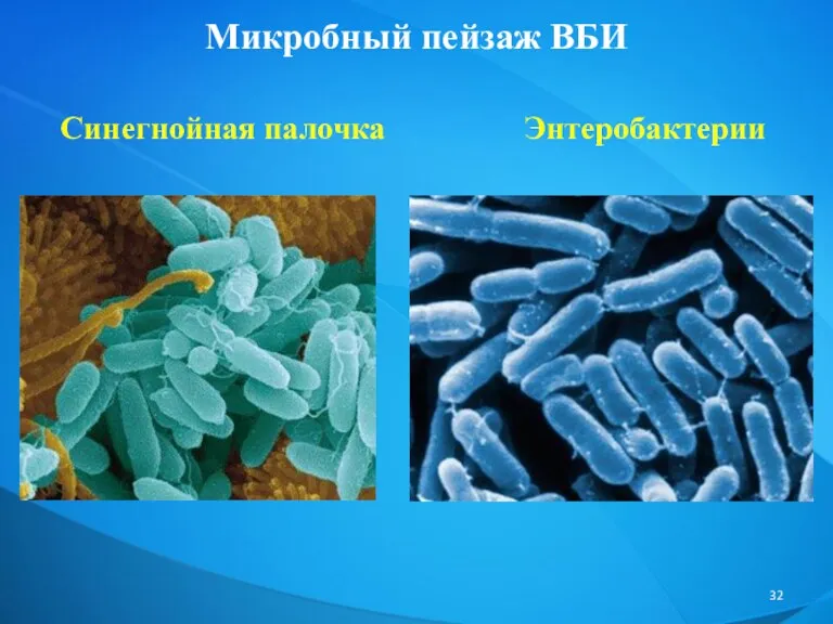 Микробный пейзаж ВБИ Синегнойная палочка Энтеробактерии