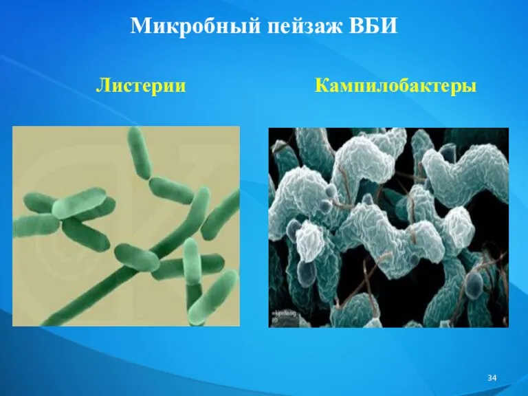 Микробный пейзаж ВБИ Листерии Кампилобактеры