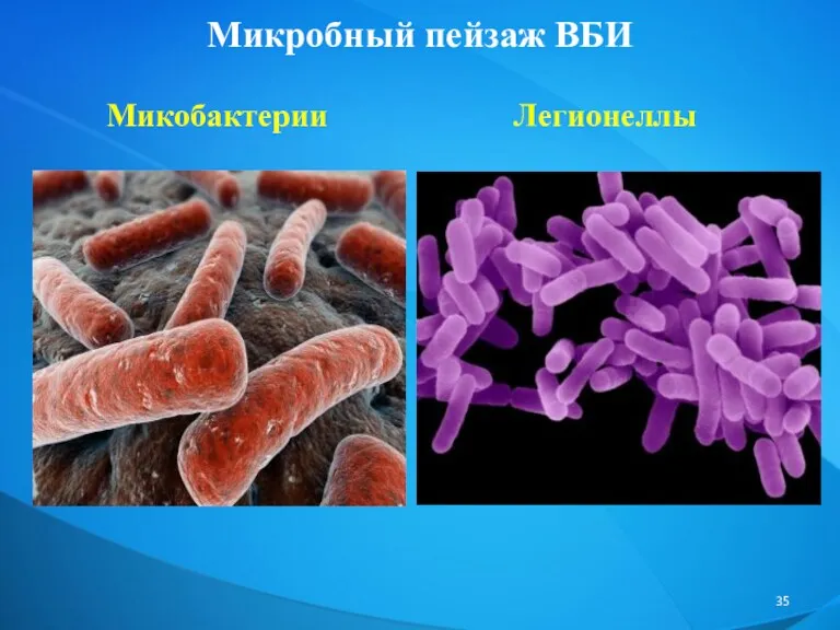 Микробный пейзаж ВБИ Микобактерии Легионеллы