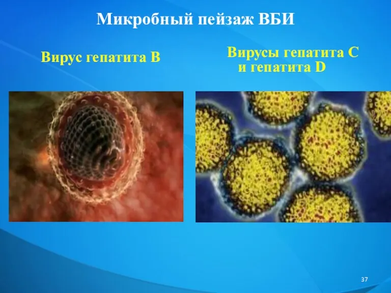 Микробный пейзаж ВБИ Вирус гепатита В Вирусы гепатита С и гепатита D