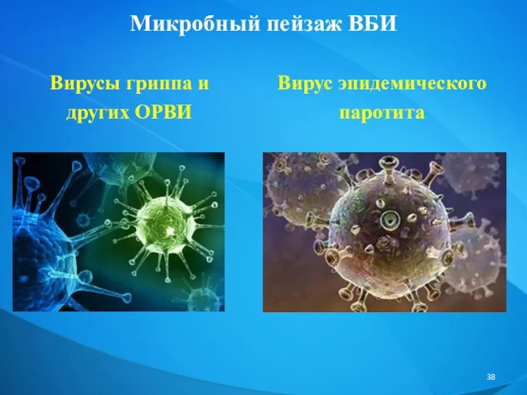 Микробный пейзаж ВБИ Вирусы гриппа и других ОРВИ Вирус эпидемического паротита