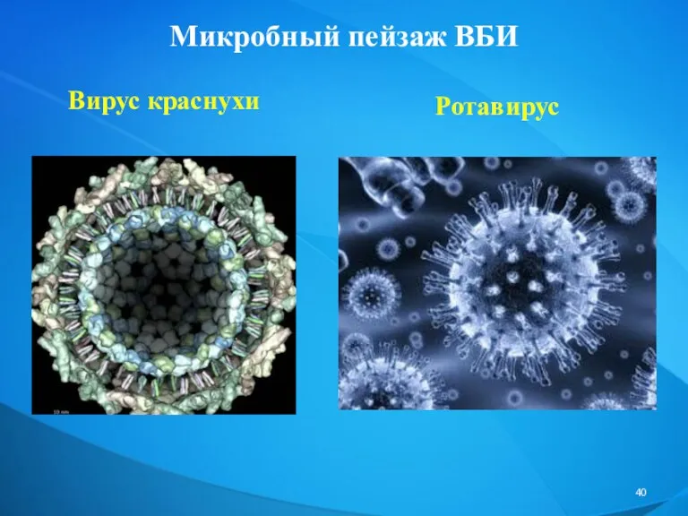 Микробный пейзаж ВБИ Вирус краснухи Ротавирус