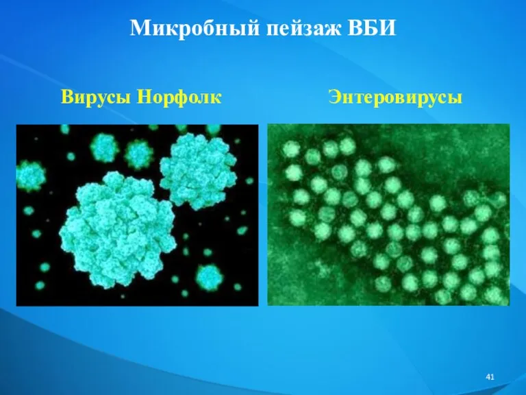 Микробный пейзаж ВБИ Вирусы Норфолк Энтеровирусы