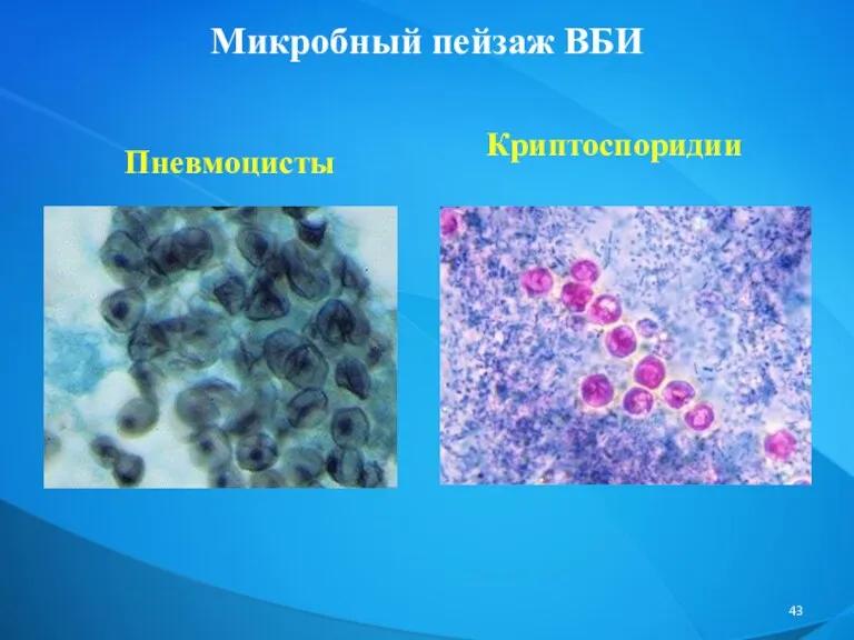 Микробный пейзаж ВБИ Пневмоцисты Криптоспоридии