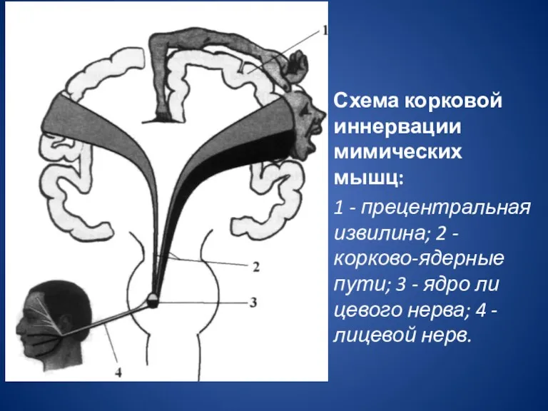 Схема корковой иннервации мимических мышц: 1 - прецентральная извилина; 2