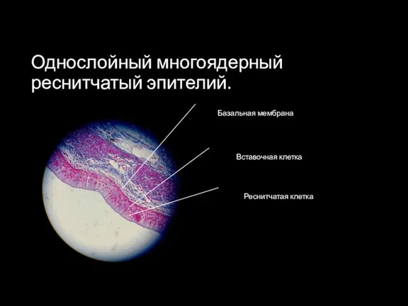 Однослойный многоядерный реснитчатый эпителий. Вставочная клетка Базальная мембрана Реснитчатая клетка