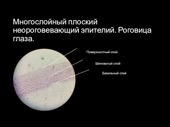 Многослойный плоский неороговевающий эпителий. Роговица глаза. Шиповатый слой Поверхностный слой Базальный слой